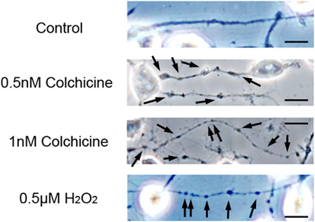 Figure 5. Colchicine induces neurite degeneration. Neuro2a cells were treated with various concentrations of colchicine. After 24 hours, the cells were fixed with 4% PFA in PBS. Photomicrographs of the cells were collected and analyzed on a personal computer. The scale bar represents 10 µm. Arrows indicate bead formation on the degenerating neurites of neuro2a cells. At least three wells were examined per experiment.