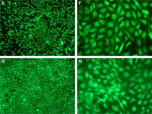 Figure 8 Fluorescence microscopy images of Calcein-AM stained MC3T3-E1 cell attached on (A and B) DCVC, (C and D) DCVC-Ag1, (E and F) DCVC-Ag2, and (G and H) DCVC-Ag3 for 3 days. Figure 9 The SEM images of MC3T3-E1 cell attachment on DCVC, DCVC-Ag1, DCVC-Ag2, and DCVC-Ag3 samples for days 3 and 7.Abbreviations: DCVC, central venous catheters coated with polydopamine films; SEM, scanning electron microscopy.Display full sizeAbbreviation: DCVC, central venous catheters coated with polydopamine films.