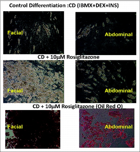 Figure 1. Facial preadipocytes are more responsive to rosiglitazone-containing differentiation compositions, relative to abdominal preadipocytes. Human facial and abdominal preadipocytes in control media (CD; insulin, dexamethasone, and IBMX), or CD plus 10 μM rosiglitazone (CDR). Lipid droplets are shown by Oil Red O staining. Microscopic images of the cells were taken on day 14 after plating. The pictures are representative of 3 individual experiments. DEX, dexamethasone; INS, insulin.