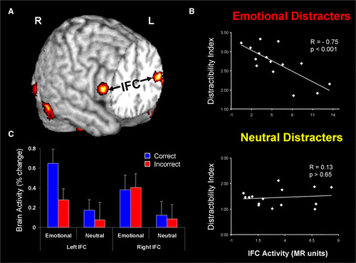 Figure 3.  Evidence for the role of lateral PFC in coping with distracting emotions. (A) Brain regions showing enhanced functional coupling with the amygdala during processing of emotional distraction—ventrolateral prefrontal cortex (vlPFC)/inferior frontal cortex (IFC) highlighted. (B) Enhanced correlation between vlPFC activity and subjective emotional distractibility scores. (C) Hemispheric asymmetry in the vlPFC/IFC during successful coping with emotional distraction. Taken together, these findings can also be interpreted as a subjective (right) versus objective (left) dissociation in the role of these regions in coping with the subjective feeling of being distracted (right vlPFC/IFC) versus actually coping with distraction (left vlPFC/IFC). Correct/Incorrect = Remembered/Forgotten items in the working memory task. Adapted from Dolcos, Kragel, et al. (2006) and Dolcos and McCarthy (2006), with permission.