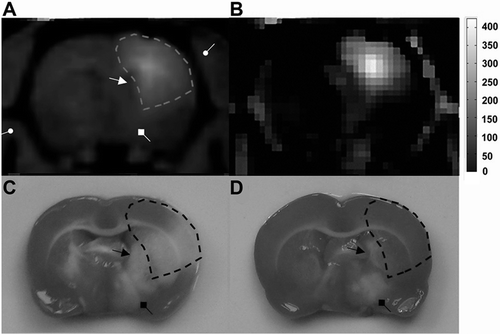Figure 4.  Potentially protected regions predicted by MRI tracer method. (A) Axial image of Gd-DTPA enhanced T1WI provided the anatomical information of brain tissues neighboring the ventricle (arrow with a triangular head), the thalamus (arrow with a square head) and the skull (arrow with a round head). (B) Pseudo-color image of MR signal enhancement 2 hours after IC injection of Gd-DTPA. (C) Characteristic ischemic lesions involved both the cortex and subcortical regions. (D) Non-deposition areas of Gd-DTPA matched exactly with the poorly protected regions in pMCAO experiment by stereotactic delivery of citicoline.