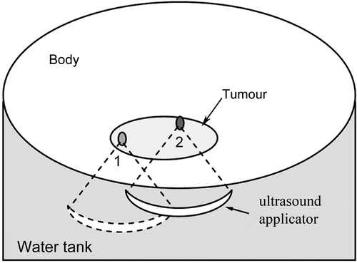 Figure 2. Diagram of tumour treatment by MRgHIFU. After finishing the treatment at position 1, the ultrasound applicator is moved to position 2. The ideal workflow is: a reference image is acquired at position 1 for temperature imaging, when the applicator is shifted to position 2, the reference image can still be used for calculating a temperature map.