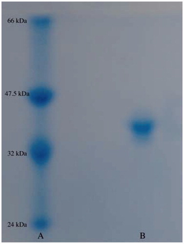 Figure 1. SDS-PAGE analysis of purified hPON1. Lane (A) is standard proteins (kD): Bovine serum albumin (66.000), aldolase (47.500), triosephosphate isomerase (32.000) and soy bean trypsin inhibitor (24.000). Lane B contains a human serum sample.