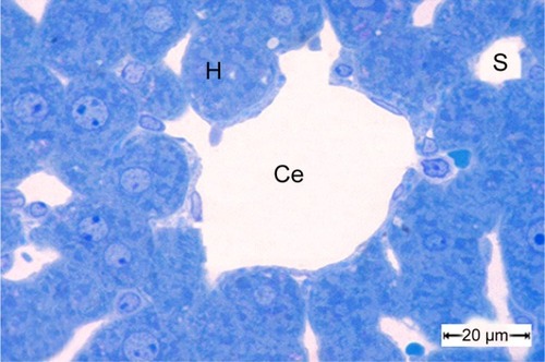 Figure 10 A semithin section of liver tissue from the control group showing the normal cytoarchitecture of the lobule.Notes: The central vein is surrounded by hepatic cells separated by blood sinusoids. Scale bar 20 μm.Abbreviations: Ce, central vein; H, hepatic cells; S, blood sinusoids.