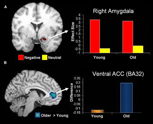 Figure 5.  Preserved amygdala function and increased amygdala-ACC connectivity in healthy ageing. (A) Coronal brain view and bar graph showing overlapping activity in the right AMY region during processing of negative pictures (Neg > Neu) in young and older adults. The y-axis represents the difference in activity between negative and neutral conditions and units are in effect size, the difference in the parameter estimates of the activation. (B) Sagittal/lateral brain view and bar graph showing age-related increase in the interaction between AMY and the anterior cingulate cortex (ACC) during processing of negative pictures. The y-axis represents the difference in correlations between negative and neutral conditions. From St. Jacques et al. (2010), with permission.