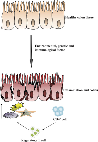 Figure 1. Schematic diagram showing the process of inflammation and colitis.