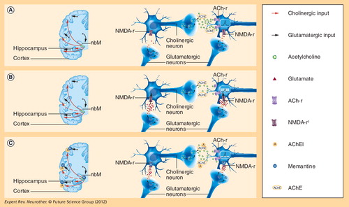 Figure 1. Normal cortical cholinergic and glutamatergic neurotransmission, changes that occur in Alzheimer’s disease, and the proposed mechanism of action of acetylcholinesterase inhibitors and memantine with respect to these changes.(A) Normal cortical cholinergic and glutamergic neurotransmission. Cholinergic innervation of glutamatergic cortical pyramidal neurons is provided by cells in the nbM in the basal forebrain. Acetylcholine (ACh) is released following depolarization to act on nicotinic and muscarinic receptors located on glutamatergic neurons, with neurotransmitter action being terminated by AChE. Glutamatergic neurons also receive innervation from other glutamatergic cortical pyramidal neurons – in this case, released glutamate acts on α-amino-3-hydroxy-5-methyl-4-isoxazolepropionic acid and NMDA receptors and action is terminated mostly by the reuptake of glutamate into associated glial cells. (B) Changes that occur in Alzheimer’s disease (AD). In AD atrophy and dysfunction of cholinergic and glutamatergic pyramidal neurons occurs such that remaining cortical neurons receive less innervation and consequently are less likely to be depolarized by synaptic signals. Signal-to-noise ratio at glutamatergic synapses would be reduced by a combination of a weaker ‘signal’ (from ACh and glutamate release in response to depolarization) and greater ‘noise’ (caused by an increased concentration of glutamate in the synaptic cleft between synaptic activation, due to partial failure of reuptake mechanisms). (C) The proposed mechanism of action of AChEIs and memantine with respect to the changes in AD. The use of AChEIs in AD is proposed to return the concentration of ACh in the synapse towards the normal level by reducing its breakdown, and thereby increasing the chance of the interaction of ACh with cholinergic receptors on glutamatergic pyramidal neurons. Memantine is proposed to reduce ‘noise’ at glutamatergic synapses by preventing the NMDA receptors from responding to the increased concentrations of glutamate present in the synaptic cleft between synaptic activation. In combination, it is proposed that the AChEIs and memantine would have their individual effects, but the potential for synergistic action occurs because an improved signal-to-noise ratio at glutamatergic synapses in the nbM would be expected to increase the firing rate of cholinergic neurons, and AChE inhibition would enhance this effect.†Glutamate receptor; α-amino-3-hydroxy-5-methyl-4-isoxazolepropionic acid receptor has been excluded for clarity.ACheE: Acetylcholinesterase; AChEI: Acetylcholinesterase inhibitor; ACh-r: Acetylcholine receptor; nbM: Nucleus basalis of Meynert; NMDA-r: NMDA receptor.Left part of each panel adapted with permission from [Danysz W, Unpublished Data].