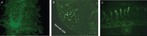 Figure 10.  Fluorescence microscopy images of intestinal segments from rat after perfusion treatment with microparticles: gut lumen surface (a), perfused segment in correspondence of a PP (b), perfused segment in correspondence of intestinal villi (c). Original magnification ×40.