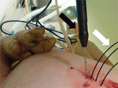 Figure 3. Experimental setup used for the in vivo experiments with the animal lying in supine position. RF applicator (black arrow) and three temperature probes (white arrow) are inserted parallel.