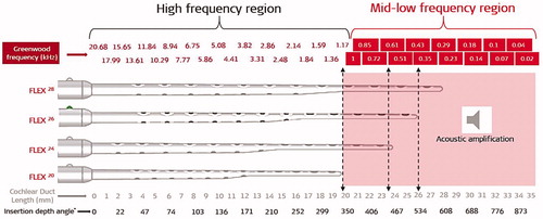 Figure 47. Illustration of Greenwood’s frequency map for an average CDL of 35 mm with an assumption of low frequency functional residual hearing, starting at 1,000Hz. Visualisation of different electrode array lengths shows how many channels would be in the acoustic amplification zone (image courtesy of MED-EL).