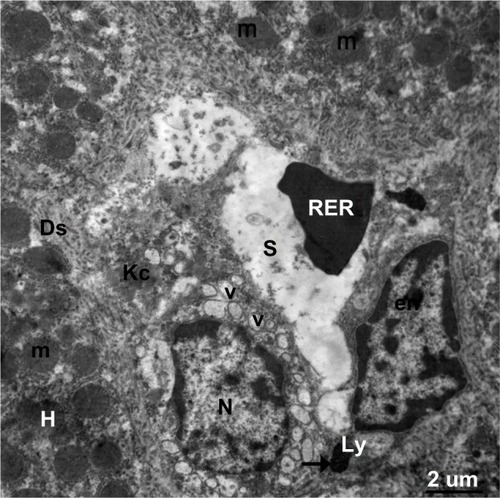Figure 21 Transmission electron micrograph showing a hepatic cell from the treated group with numerous mitochondria, hypertrophied endothelial and Kupffer cells containing numerous membranous vesicles, and electron-dense silver nanoparticles (arrow) within a lysosome. The blood sinusoid contains an individual red blood cell. Note the fragmented microvilli in Disse’s space. Scale bar 2 μm.Abbreviations: Ds, Disse’s space; en, endothelial cell; H, hepatic cell; Kc, Kupffer cells; Ly, lysosome; m, mitochondria; N, nucleus; RBC, red blood cell; S, blood sinusoid; V, vesicles.