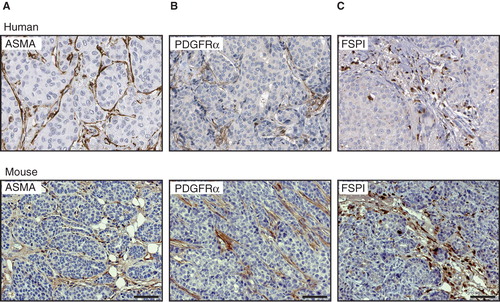 Figure 3. Correlation between CAF markers in mouse and human breast cancer. Immunostainings for ASMA (A), PDGFRα (B), and FSP1 (C), show a similar expression pattern in human (upper panel) and mouse (lower panel) mammary tumour tissue. Scale bar is indicated in the figure and represents 50 µm.
