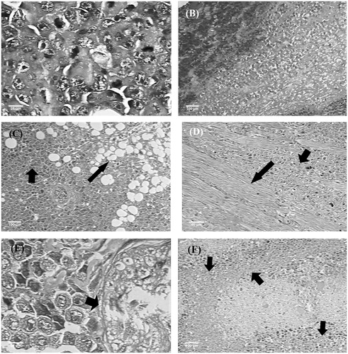 Figure 3. Histopathology of tumours of different experimental groups. (A) Tumour control: asymmetric mitoses. (B) 5-FU (25 mg/kg): coagulative necrosis areas. (C) EOX (50 mg/kg): invasion of adipose tissue (arrows). (D) EOX (50 mg/kg): invasion of skeletal muscle (arrows). (E) EOX (100 mg/kg): tumour growth advancing neural filament, without nerve infiltration (arrows). (F) EOX (100 mg/kg): coagulative necrosis areas (arrows). Haematoxylin-eosin (A, C, D, F) and Masson’s trichrome (B, E).