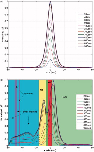 Figure 3. Profiles of the normalised temperature rise distribution along a line of the computational models of tumour tissue embedded in normal liver tissue. The line is at a distance of 0.5 cm below the electrode tip. (A) Two-compartmental liver model (maximum ΔT = 0.63 °C). (B) Realistic geometry (maximum ΔT = 2.24 °C).