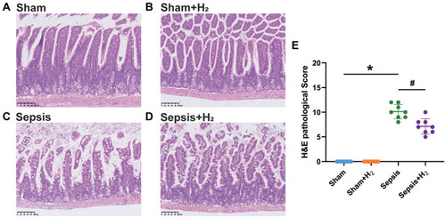 Figure 3 H2 can alleviate intestinal pathological damage caused by sepsis. Intestinal tissues were obtained at 24 h after sham or CLP operation. The structures of intestinal villi were normal in Sham (A) and Sham+H2 (B) group. Intestinal villi were disordered, submucosal and primary blood vessels were congested, and the continuity of intestinal villi was broken in Sepsis (C) group. The small intestine histology change in Sepsis+H2 (D) group were significantly improved compared with Sepsis group. (E) HE histopathological scores for each group. Results were displayed as mean ± SD (n = 6). Scale bar = 100 µm. *P < 0.05 versus Sham group, #P < 0.05 versus Sepsis group.