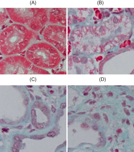 FIGURE 3. Collagen/fibrosis caused by UUO (Masson staining). (A) No abnormal changes were detected in sham-operated rats. (B) In UUO group, mild tubulointerstitial damage was noticed at 3d after obstruction. (C) At 7d after obstruction, UUO group showed renal interstitium widening and collagen deposition. (D) In UUO group, renal interstitial fibrosis significantly increased at 14d after obstruction, with increased extracellular matrix complexity and obvious collagen deposition. Original magnification × 400.
