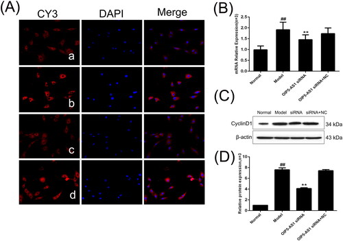 Figure 9. The changes of cyclin D1 protein and mRNA expression in FLSs from AA rats after lncRNA OIP5-AS1 siRNA. (A) The change of cyclin D1 protein expression was observed by immunofluorescence (×200; a: normal group; b: model group; c: lncRNA OIP5-AS1 siRNA group; and d: lncRNA OIP5-AS1 siRNA + NC group). (B) The change of cyclin D1 mRNA expression was evaluated by qRT-PCR. (C) The change of cyclin D1 protein expression was analysed by Western Blot analysis. (D) Semiquantitative analysis of cyclin D1 protein. ##P<0.01 compared to the normal group; *P<0.05 and **P<0.01 compared to the model group. Normal: normal synovial cells; Model: FLSs from AA rats; OIP5-AS1 siRNA: lncRNA OIP5-AS1 siRNA2; OIP5-AS1 siRNA + NC: negative control for siRNA.