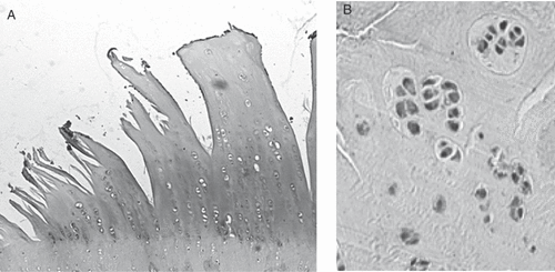 Figure 3. Histological features of cartilage in osteoarthritis. Osteoarthritic cartilage demonstrates severe fibrillation leading to cracking that extends into the tidemark. There is an obvious decrease in the numbers of chondrocytes in the late phase of the disease (A), while cluster formations, corresponding to chondrocyte proliferation, are sometimes observed to be adjacent to the area of fibrillation in the early phase (B).