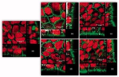 Figure 4. Uptake/adhesion of AgNPs after 24 h exposure. Confocal microscopy images of 21-day-old Caco-2/HT29-MTX cells. (a) without exposure to AgNPs (negative control), after exposure to 2500 μg/L, (b) pristine (LA) AgNPs, (c) pristine (Cit) AgNPs, (d) IVD (LA) AgNPs, and (E) IVD (Cit) AgNPs. Nuclei were stained in red (RedDot-2), actin was stained in green (Alexa-488 Phalloidin) and AgNPs are shown in white (back scatter).