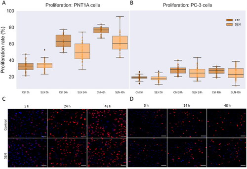 Figure 5. Cell proliferation in the presence of SLN in PC-3 and PNT1A cells. Cells were plated at a density of 5×104 cells/well onto coverslips. After overnight incubation, the cells were serum starved for 24 h. Next, the cells were incubated with SLN:pET28A for 4 h. After that, the medium was replaced by RPMI without FBS but containing EdU, and after 5, 24, and 48 h, the cells were fixed with 4% PFA and prepared for Click-iT Plus EdU Cell Proliferation Kit for Imaging, Alexa Fluor 647. The images were acquired in a Cytation 5 Cell Imaging Multi-Mode Reader (BioTek Instruments, Inc., Winooski, VT, USA) with a 20× objective. Cell proliferation rate is based on the ratio of cells labeled with EdU (in red) to the total cells (DAPI, in blue) at 5, 24, and 48 h for PNT1A (A) and PC-3 (B) cells; Representative images of the control cells and treated with SLN after 5 h, 24 h, and 48 h of PNT1A cells (C) and PC-3 cells (D). Each value represents the median (central line in the boxplot) ± the lower quartile, the upper quartile, and outliers represented by points above or below the boxplot, from two independent experiments (n = 2) p<0.05 significant difference by One Way ANOVA. About 7,000 cells were counted in each treatment. Scale bar 100 μm.