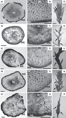 Figs 65–79. Cross sections of thalli and details of receptacles of Cystoseira 3 (here proposed as Carpodesmia). Figs 65–69. Primary branches. Fig. 65. Cystoseira amentacea (HGI – A 14601). Fig. 66. Cystoseira brachycarpa (HGI – A 14552). Fig. 67. Cystoseira crinita (HGI – A 14570). Fig. 68. Cystoseira mediterranea (HGI – A 9427). Fig. 69. Cystoseira zosteroides (HGI – A 3054). Figs 70–74. Details of the three vegetative tissues. Fig. 70. Cystoseira amentacea (HGI – A 14601). Fig. 71. Cystoseira brachycarpa (HGI – A 14552). Fig. 72. Cystoseira crinita (HGI – A 14570). Fig. 73. Cystoseira mediterranea (HGI – A 9427). Fig. 74. Cystoseira zosteroides (HGI – A 3054). Figs 75–79. Receptacles (arrows). Fig. 75. Cystoseira amentacea (HGI – A 14601). Fig. 76. Cystoseira brachycarpa (HGI – A 14552). Fig. 77. Cystoseira crinita (HGI – A 14570). Fig. 78. Cystoseira mediterranea (HGI – A 9427). Fig. 79. Cystoseira zosteroides (HGI – A 3054). Meristoderm (mt), cortex (c) and medulla (m). Scale bars: Figs 65–74 = 100 μm; Figs 75–79 = 1 mm.
