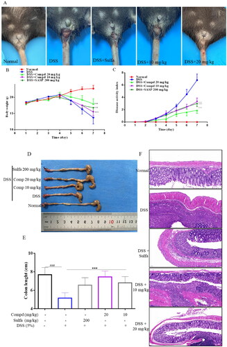 Figure 8. Compound E2 alleviates DSS-induced colitis in mice. (a) Mice show bloody stools (b) Weight change; (c) DAI was calculated; (d, e) Measuring the length of the colon; (f) Histopathological analysis of mouse colon. Data are represented as mean and SEM. Sulfasalazine (SASP) was used as a positive control drug. Compared with the Normal group, ### P < 0.001; Compared with DSS treated group, *** P < 0.001.