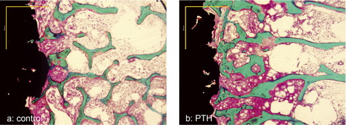 Figure 4. Photomicrographs of histological samples. Panel a: control. Panel b: parathyroid hormone (PTH). Scale: 900 μm. Staining technique: 0.4% basic fuchsin (red) and 2% light green (with bone staining green).