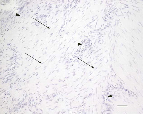 Figure 3. Microscopic longitudinal section (H&E stained) of an injured tendon (H) showing a disorganized region with high amount of fibroblastic cells (arrows) and many vessel-like structures (arrowheads) compatible with neovascularization. H refers to tendon ID (see Tables 1 and 2). Bar = 100 μm.