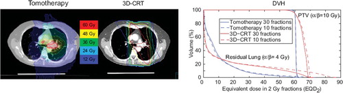 Figure 2. An illustrative case with a tomotherapy and a 3D-CRT plan and the corresponding dose volume histograms corrected for fractionation by using α/β = 4 Gy for the residual lung and α/β = 10 Gy for the tumor.