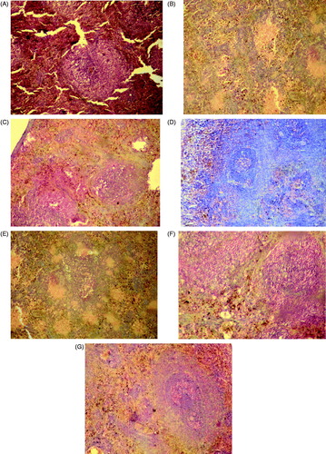 Figure 4. Histopathological observation of experimental rats pancreas after 30 days of treatment (A) normal control; (B) diabetic control; (C) diabetic animals treated with PABEF (400 mg/kg); (D) diabetic animals treated with PABE1 (30 mg/kg); (E) diabetic animals treated with PABE2 (30 mg/kg); (F) diabetic animals treated with PABE3 (30 mg/kg); (G) diabetic animals treated with glibenclamide (600 µg/kg).