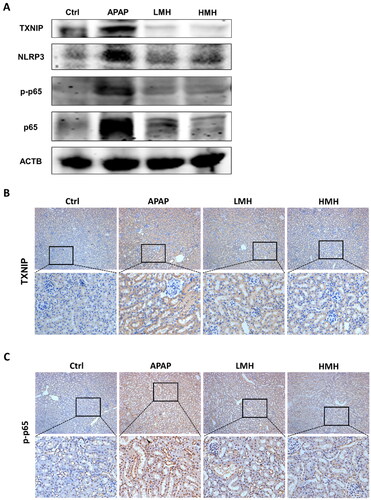 Figure 5. MgH2 suppresses APAP-induced TXNIP/NLRP3/NF-κB signaling pathway activation in kidneys of mice.(A) The protein expressions of TXNIP, NLRP3, NF-κB p65 and p-NF-κB p65 in kidneys of mice were detected by western blotting.(B, C) The protein expressions of TXNIP and p-NF-κB p65 in kidneys of mice were detected with immunohistochemistry staining.