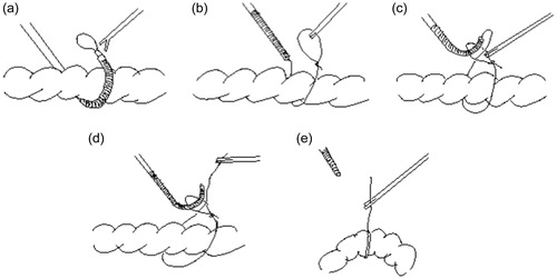 Figure 15. Ligating procedure using the developed mechanism.