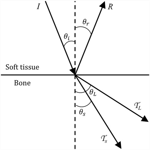 Figure 2. Ultrasound reflection and refraction at bone/soft tissue interfaces, as used to derive the models herein. An incident wave strikes the bone surface at angle and intensity I. The reflected wave, refracted longitudinal wave, and refracted shear wave have intensities R, TL, and TS and travel at angles , , and , respectively.