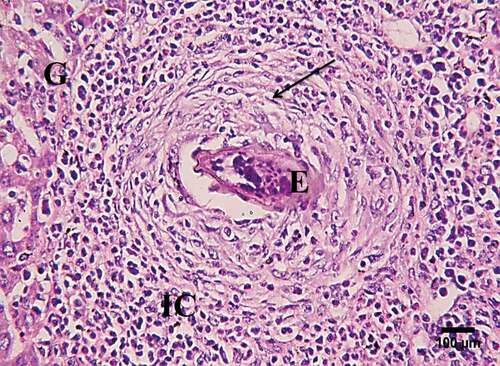 Figure 3. A photomicrograph of sections of infected liver showing a high magnification (400X) of granuloma (G) with central eggs (E), surrounded by fibro-collagen bundles entangling fibroblasts (arrows) and inflammatory cells (IC) (H&E, scale bar = 100 µm).