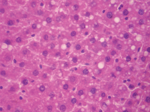 Figure 7.  Histopathologic presentation of male rat liver of CF 400 mg/kg group (Intracellular accumulations/Fatty change; 400×).