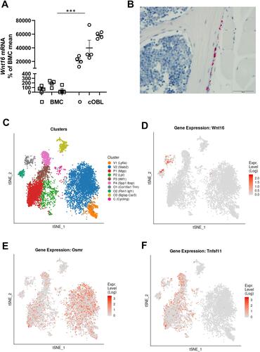 Figure 6 Expression of Wnt16 in calvarial bone cells and bone marrow cells analyzed by PCR, in situ hybridization and scRNAseq. (A) Expression of Wnt16 in three bone marrow cell (BMC) cultures and three calvarial bone cell (cOBL) cultures cultured in osteogenic media for 7 and 6–8 days, respectively. Individual values are presented with the mean shown as horizontal lines and ±SEM as vertical lines. ***P<0.001 BMC vs cOBL, two-way ANOVA. (B) RNAscope of Wnt16 expression (red) in L5 vertebrae. Scale bar, 50 µm. (C–F) Single cell RNA sequencing analysis of bone marrow stromal cells using nicheExplorer.Citation52 Reprinted with permission from Springer Nature Customer Service Centre GmbH; Springer Nature; Nature; The bone marrow microenvironment at single-cell resolution, Anastasia N. Tikhonova et al, © 2019, www.aifantislab.com/niche. (C) t-SNE visualization of endothelial (V1-2), perivascular (P1-4), osteo-lineage (O1-3) and one mitotic cell cluster (cycling) identified by Tikhovona et al.Citation52 Feature plots of Wnt16 (D), Osmr (E) and Tnfsf11 (F) expression.