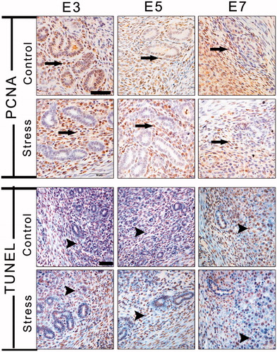 Figure 7. Immunohistochemical staining with PCNA was used to visualize uterine cell proliferation, and the TUNEL method detected apoptosis of endometrial cells. Long arrows indicate a PCNA-positive cell and arrowheads indicate a TUNEL-positive cell. E3: Embryonic day 3; E5: Embryonic day 5; E7: Embryonic day 7; PCNA: Proliferating cell nuclear antigen; TUNEL: Terminal deoxynucleotidyl transferase dUTP nick end labeling. Bar = 50 μm.
