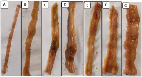 Figure 3. Representative samples of colon tissue in TNBS induced UC in rats. (A) NC; (B) EC; (C) DC; (D) NG 20; (E) NG 40; (F) NG 80; (G) DEX.