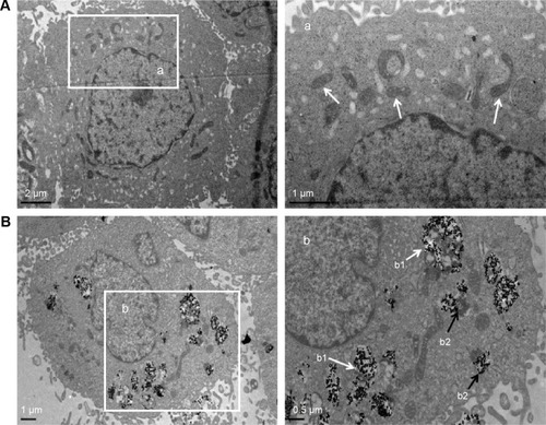Figure 2 The TEM images of cellular uptake of BEAS-2B cells exposed to the TNPs (25 μg/mL) for 24 hours.Notes: (A) Control group. (a) The magnification of selected area of control showed evidently intact mitochondrias (white arrows). (B) TNPs dispersed in cytoplasm either free or as membrane-bound aggregates. (b1) The TNPs deposited in mitochondria (white arrows); (b2) The TNPs localized in lysosomes (black arrows).Abbreviations: TNPs, titanium dioxide nanoparticles; TEM, transmission electron microscope.