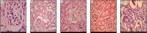 Figure 2.  Photomicrographs of histology of mice kidney. (A) Non-diabetic; (B) Diabetic control; (C) Acarbose (50 mg/kg, p.o.); (D) MUAI (1 mg/kg, p.o.); (E) MUAI (1 mg/kg, p.o.)+2% starch solution.