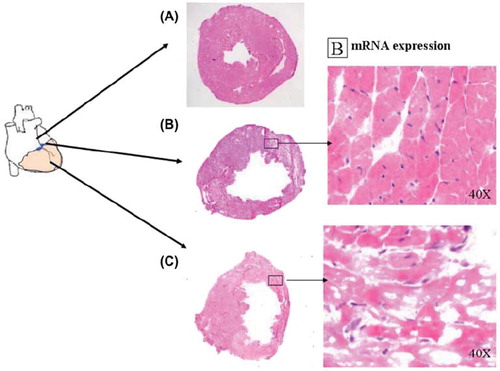Figure 1. Transmural myocardial infarction (C) in murine left ventricle 12 days after ligation of the LAD. Immunostainings and mRNA analyses were done on cross sections at the periinfarct level (B). Eosin hematoxylin staining. (A) indicates non-infarcted myocardium.