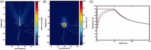 Figure 7. Slice of the 3 D anatomy used in simulations. (A) Outline of bone with respect to the RMS pressure. Thermal rise for a 50 s sonication at 30 W : 2 D map (B) and time curves (C) of the temperature at the surface of the bone (black), 0.75 mm (blue) and 1.125 mm (red) away in tissue.