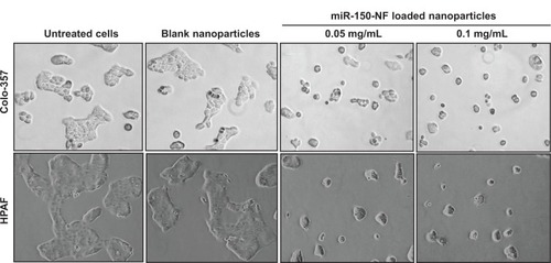 Figure 5 Treatment of pancreatic cancer cells with miR-150-NF alters the morphology of pancreatic cancer cells.Notes: Pancreatic cancer cells were seeded in six-well plates and allowed to attain 60%–70% confluence prior to miR-150-NF (0.05 or 0.1 mg/mL) treatment for 48 hours. Representative micrographs are from one of the random fields of view (magnification 100×) of cells.Abbreviation: NF, nanoformulation.