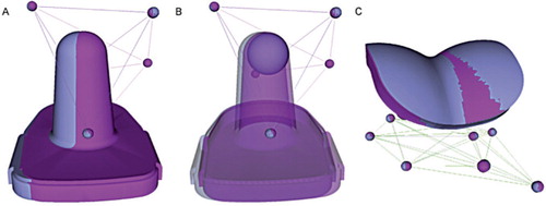 Figure 1. Sample double-examination results for one patient, depicting overlaid implant positions from each RSA examination (gray and magenta), which should be identical. The mismatch in the tibial component (A) showed high imprecision of the system due to the symmetry of the implant. Simplification of the implant to its spherical tip (B) greatly improves the precision. The position of the talar component (C) was precisely repeated in this double examination.