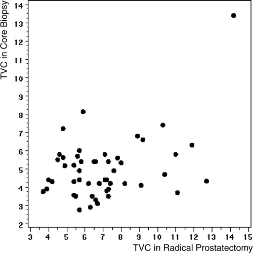 Figure 2. The relationship between MVD in preoperative core biopsy and postoperative prostate specimen. Correlation coefficient of 0.41 was found (P = 0.003)