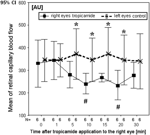 Figure 3. Mean of retinal capillary blood flow (RCF) before, 1, 5, 10, 15, 20 and 30 min after tropicamide application to the right eye; N, number of paired samples; significance *0.05 ≥ p ≥ 0.01, comparison of RCF between the right eyes and the left eyes; #comparison between RCF in the time of the measurement after and before tropicamide application (Wilcoxon test).
