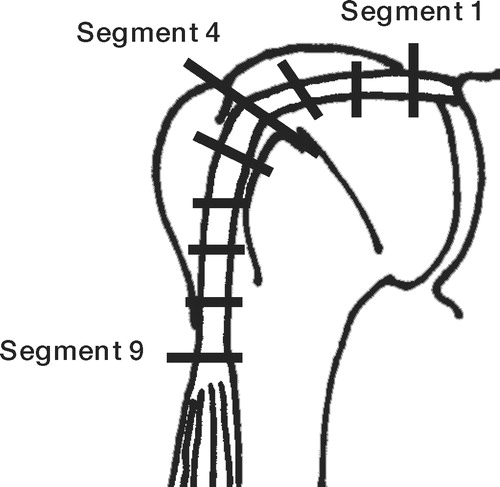 Figure 1. Sites of cross-sectional area (CSA) measurement. The CSA of the LHB tendon was measured at 9 different levels. The distal stump of each segment was sectioned into a thin slice and measured using NIH Image. Segment 1:glenoid origin. Segment 4:entrance to the bicipital groove. Segment 9: musculotendinous junction.
