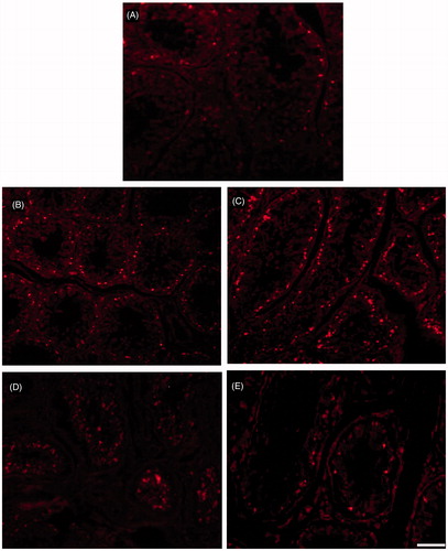 Figure 4. Photomicrograph of fluorescent microscopic images of TUNEL apoptotic positive cells (TMR red) in testis from various experimental groups. TUNEL positive cells (bright fluorescent spots) in seminiferous epithelium of the testis. (A–E) from sham-control, unoperated and operated side short-term testes, and unoperated and operated side long-term testes, respectively. The number of apoptotic cells identified by TUNEL was greater in seminiferous epithelium of both short and long-term bilateral and unilateral vasectomized animals when compared to the control. When compare to long-term testis short-term testis shows more apoptotic positive cells. Scale bar = 80 µm.