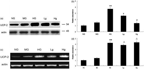 Figure 1. UCP2 expression in different groups. (a) UCP2 protein expression in western blot analysis. (b) Graphic presentation of relative UCP2 abundance normalized to actin. (c) UCP2 mRNA expression in RT-PCR analysis. (d) Graphic presentation of relative UCP2 mRNA abundance normalized to actin. * p < 0.05 vs. HG; #p < 0.01 vs. HG; △p > 0.05 vs. HG ; **p < 0.01 vs. NG.