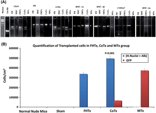 Figure 6. Human hepatocyte-specific gene expression as detected by RT-PCR and quantification of engrafted cells. (A) Expression of CK19, ALB, AFP, HNF-1α, HNF-1β, HNF-4α and CYP3A7 mRNA was analyzed by RT-PCR of mouse livers after transplantation. The detoxifying enzyme CYP3A7 transcript and human-specific CK19, ALB, AFP, HNF-1α, HNF-1β and HNF-4α were specifically expressed in CoTx mouse livers. (B) Engrafted cells in the FHTx, CoTx and MTx groups were counted manually from five different liver regions and presented in cells in cm/mm3. Cells positive for human nuclei and ALB were highest in the CoTx group. GFP+ cells were highest in the MTx group.